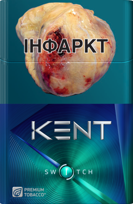 KENT SWITCH